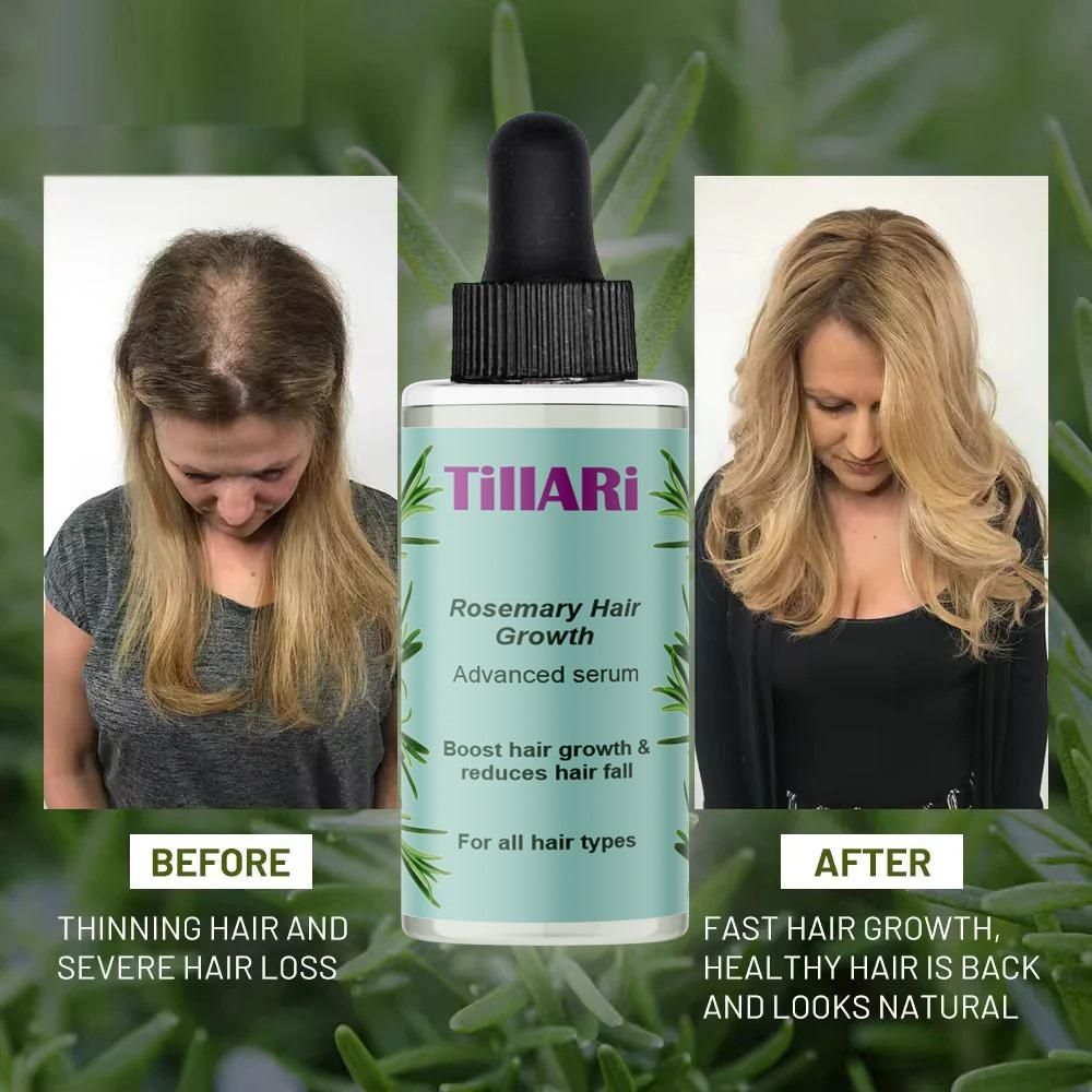Tillari Rosemary Hair Growth Serum